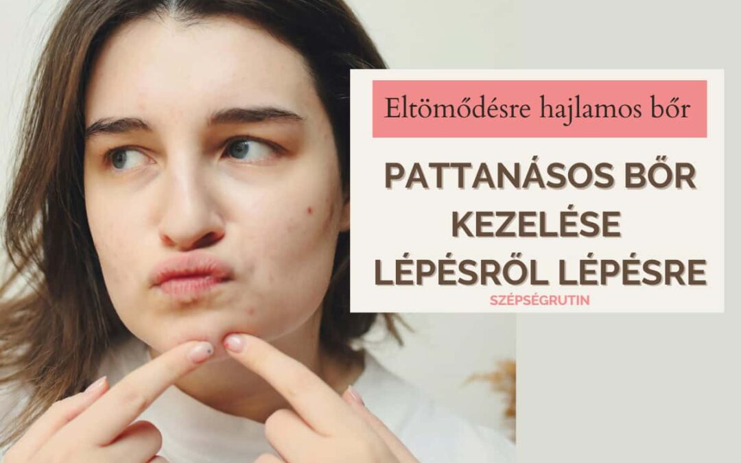 Pattanásos bőr kezelése lépésről lépésre – így tisztul ki a bőröd akkor is, ha hajlamos vagy aknéra, mitesszerre