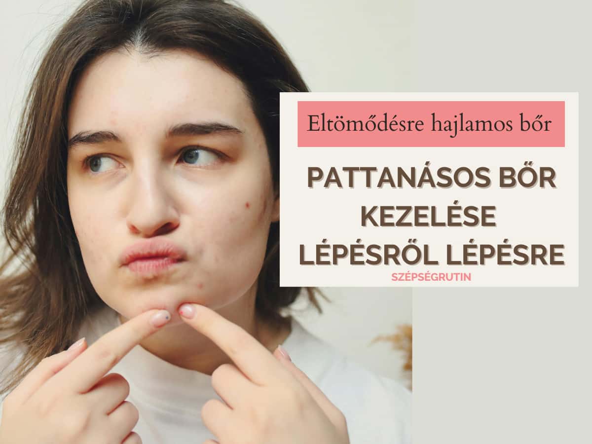 pattanásos bőr kezelése