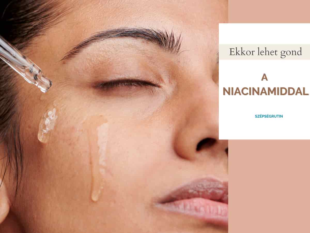 niacinamid mentes 2
