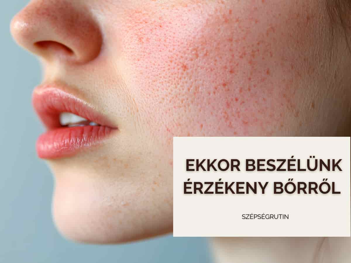 érzékeny bőr ápolása 1