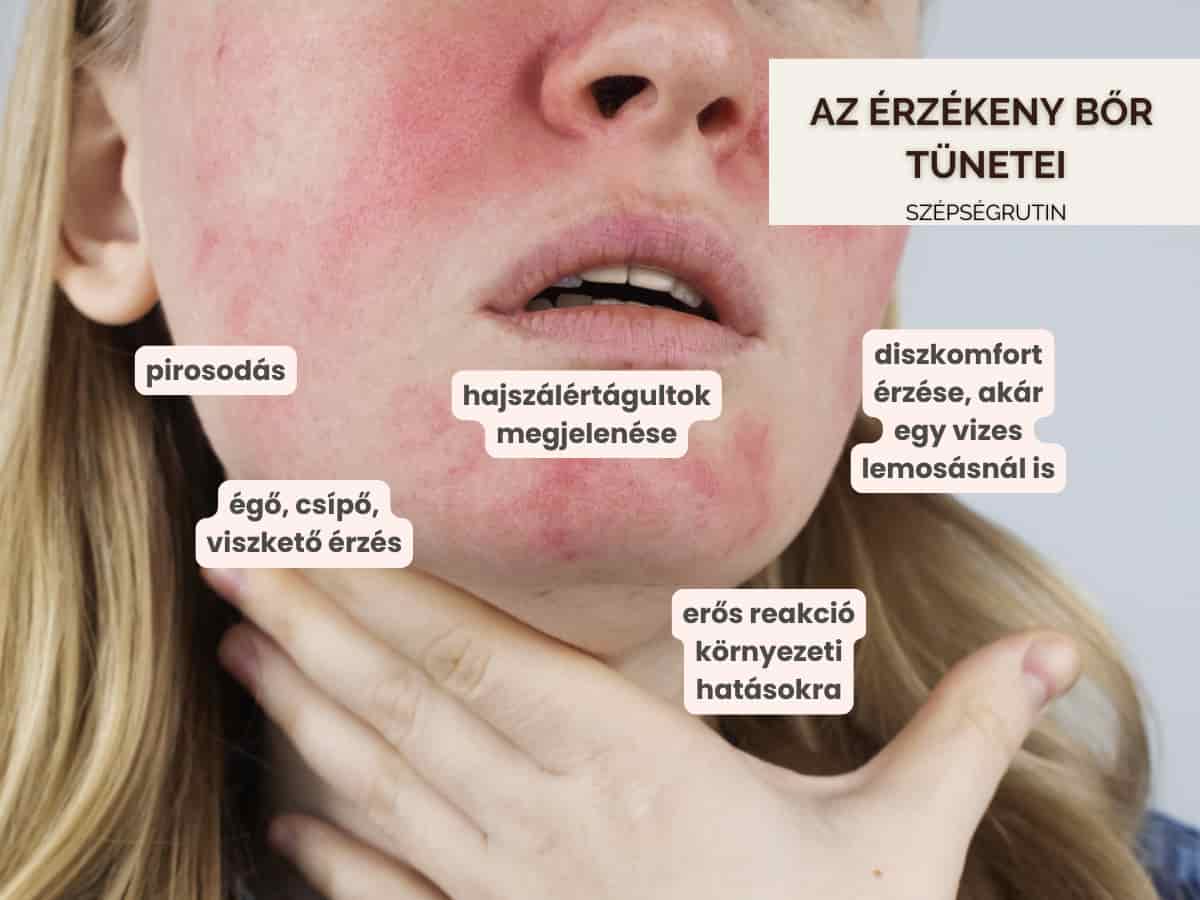 érzékeny bőr ápolása 2