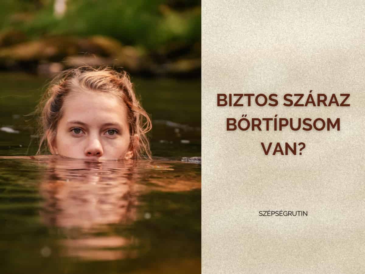 száraz bőr 1